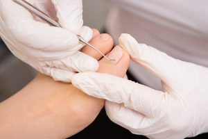 Detailaufnahme einer Fußnagelbehandlung für ein perfektes Ergebnis.